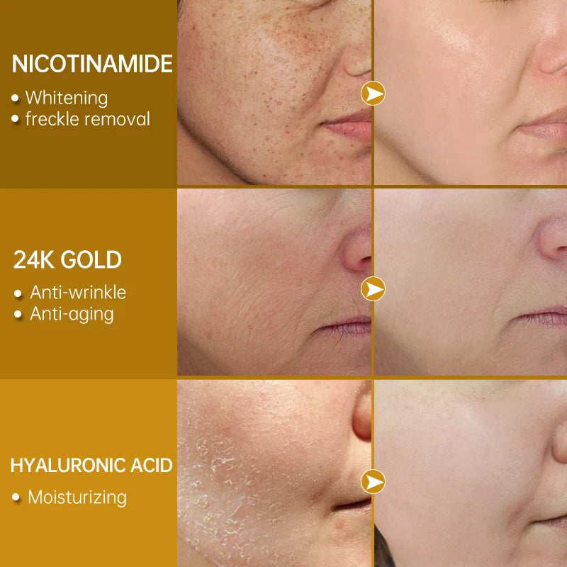 Niacinamide Face Serum Dark Spots Remover Hyaluronic Acid 24k Gold Facial Serum Fade Fine Lines Whitening Moisturizing Skin Care