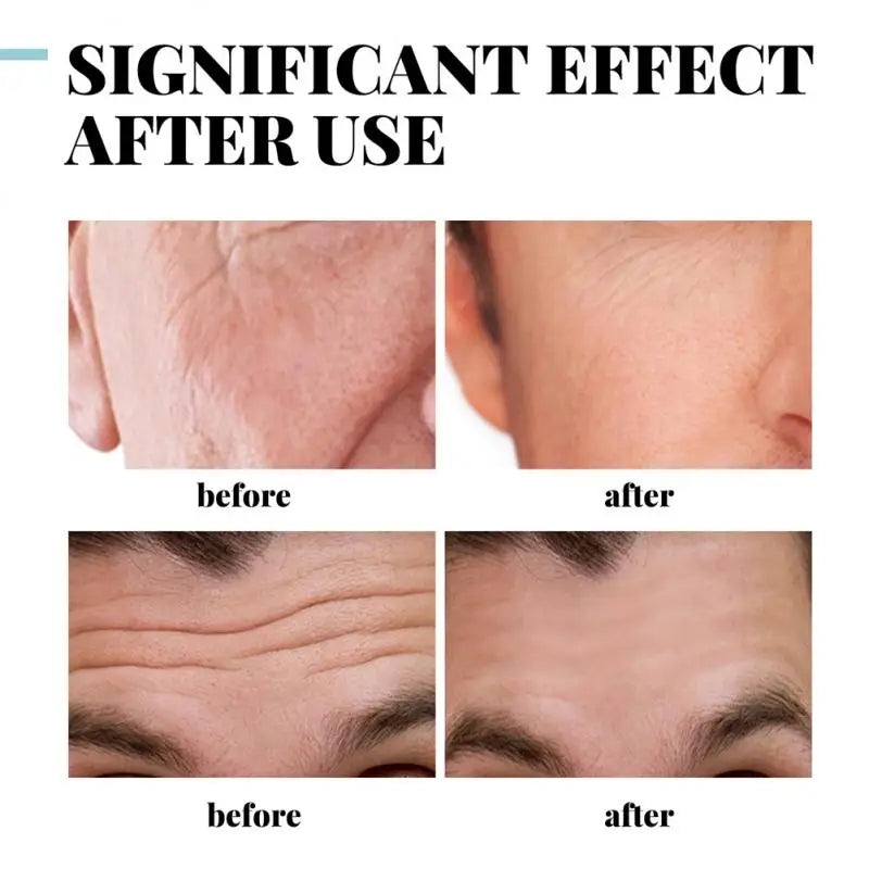 Men Collagen Anti-Wrinkle Cream Hyaluronic Remove Wrinkles Moisturizing Anti-Aging Firming Lifting Whiten Brightening Face Care